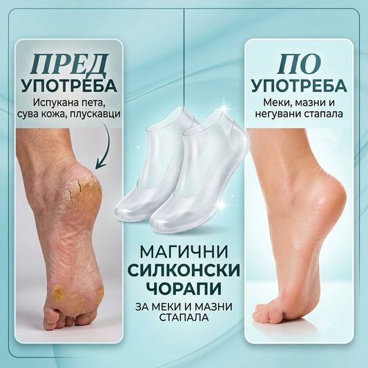 Магични Силиконски Чорапи – За Меки и Мазни Стапала Без Испукнатини!